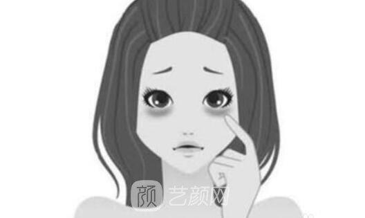 如何快速去除黑眼圈?