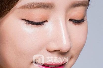 成都韩式隆鼻多少钱?