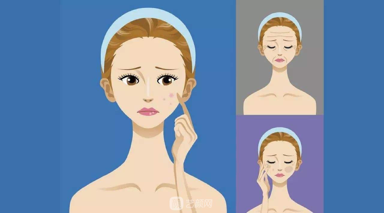 光子嫩肤有副作用吗?光子嫩肤的副作用有哪些?