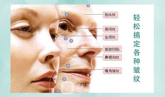 北京保妥-适除皱价格多少?