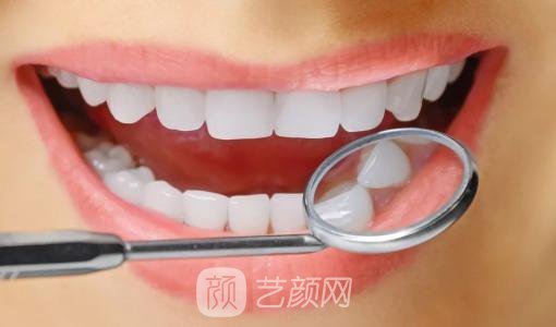 美白牙齿需要多少钱?