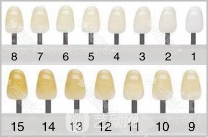 美白牙齿需要多少钱?