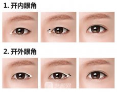 上海韩式开眼角多少钱?