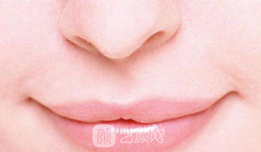 仰月唇是什么?仰月唇图片~