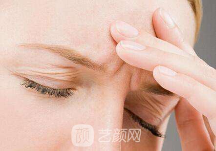 去除表情纹的方法有哪些?