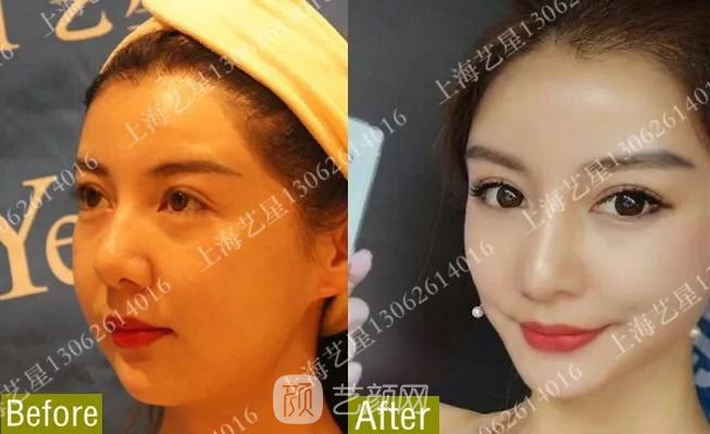 《爱情公寓》集体变脸！离婚的她才20岁？ 