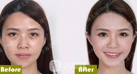 《爱情公寓》集体变脸！离婚的她才20岁？ 