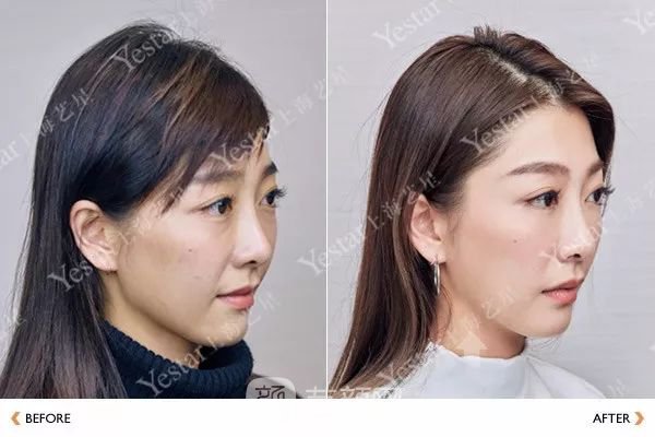《爱情公寓》集体变脸！离婚的她才20岁？ 