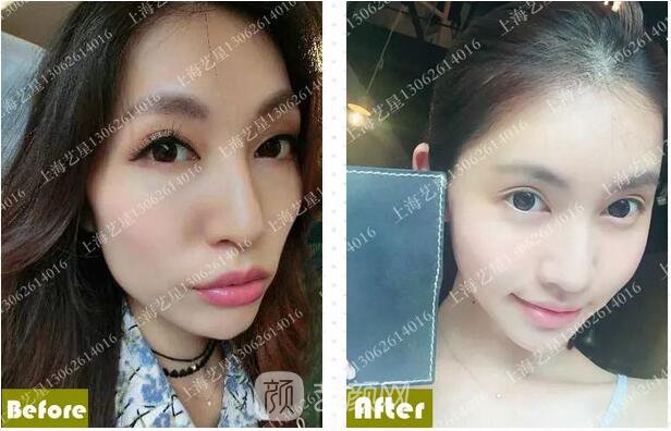《爱情公寓》集体变脸！离婚的她才20岁？ 