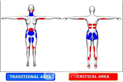光纤溶脂多少钱?