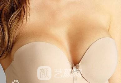 杭州韩式隆胸整形费用?