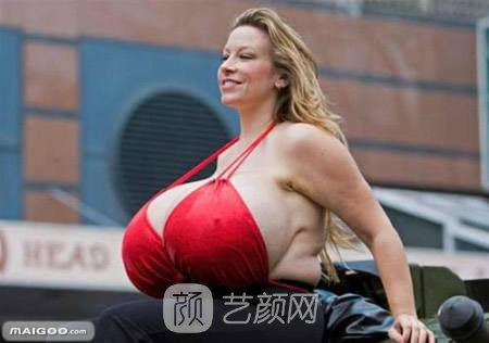乳房缩小大概多少钱?