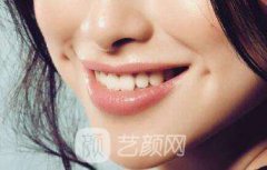厦门人造酒窝价格?