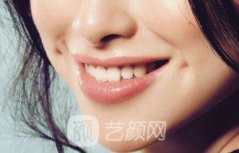 厦门人造酒窝价格?