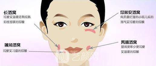 厦门人造酒窝价格?