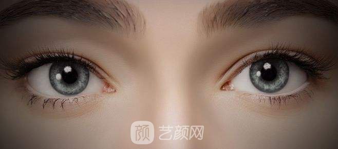 美杜莎综合美眼的优势?