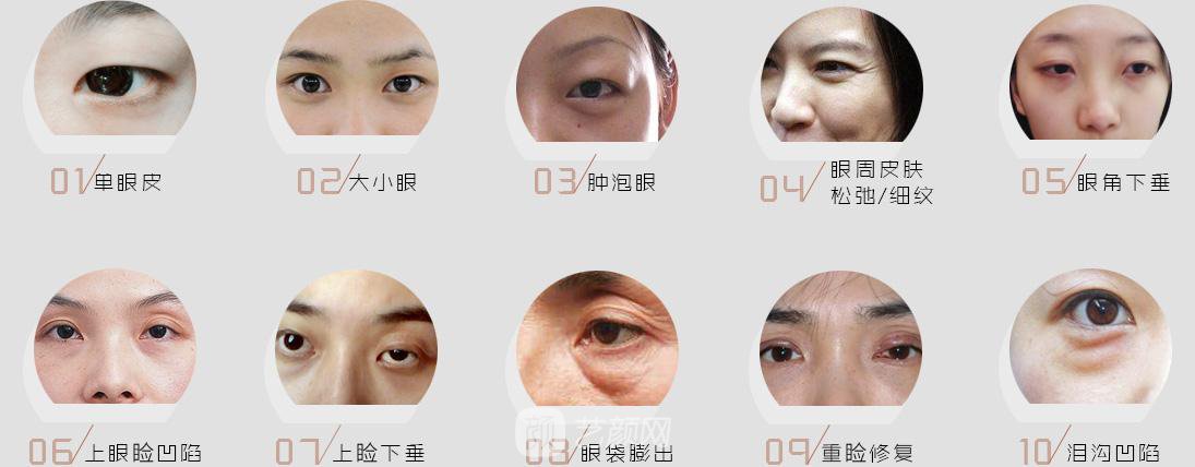 美杜莎综合美眼的优势?