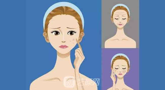 光子嫩肤是什么手术