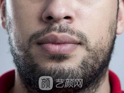 有什么能促进面部毛发生长吗？急需、在线等~