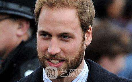 有什么能促进面部毛发生长吗？急需、在线等~