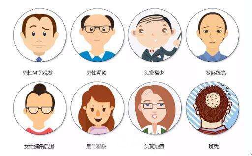 头发移植费用多少钱呢