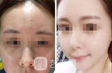 刘冬青医生案例