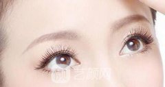 长沙微创开眼角多少钱?