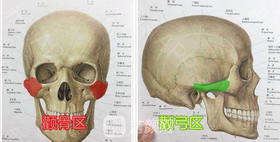颧骨内推术后要注意什么?