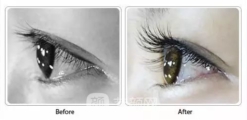 sht睫毛种植果好吗?