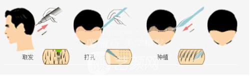 成都种植睫毛多少钱?