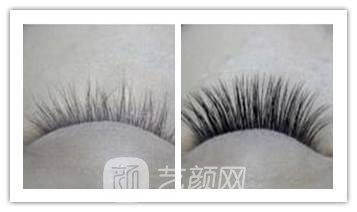 成都种植睫毛多少钱?