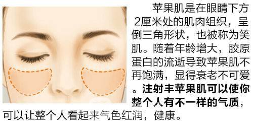 胶原蛋白丰苹果肌哪家医院好?