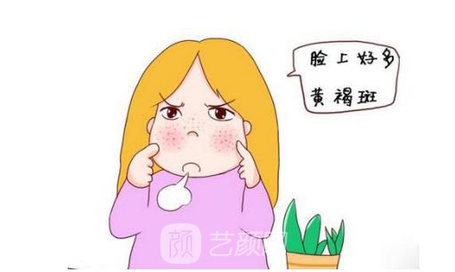 【激光祛斑会不会反弹？】