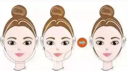 光纤溶脂瘦脸能热敷吗?