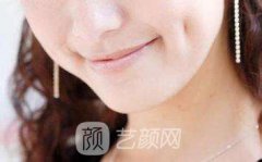 北京人造酒窝费用多少?