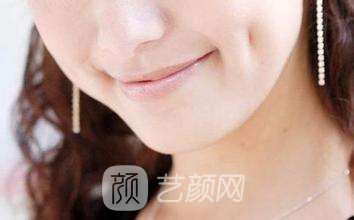 北京人造酒窝费用多少?