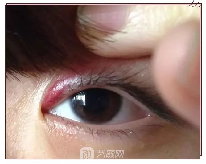 如何不整容也能拥有芭比大眼睛？让你过年聚会成为较会放电的妞！