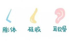 假体隆鼻能维持多久？术后10年需每年检测一次价格几千到几万不等~