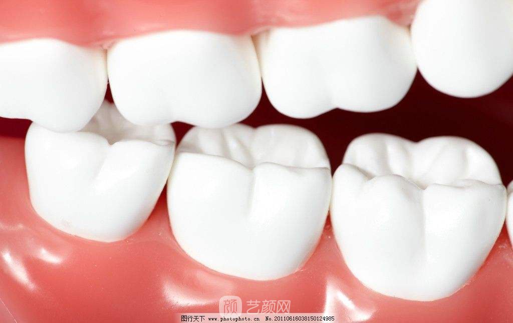 登腾种植牙是什么?