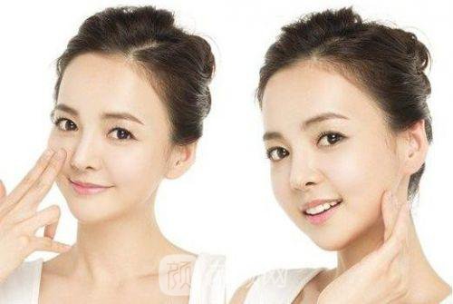 vline溶脂果好吗?