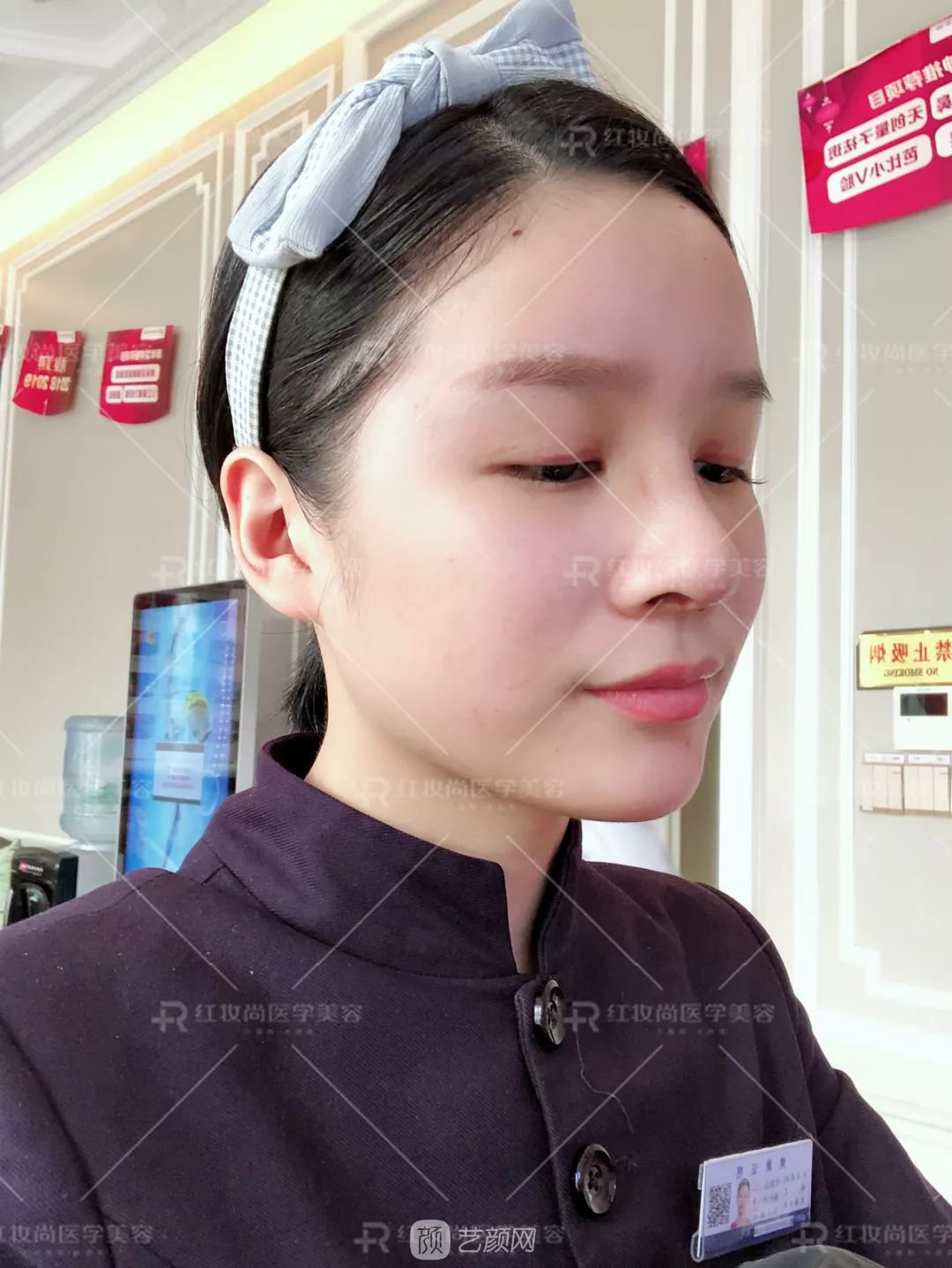 【蜕变日记】绝美侧颜的秘密——分享我的美鼻之旅~
