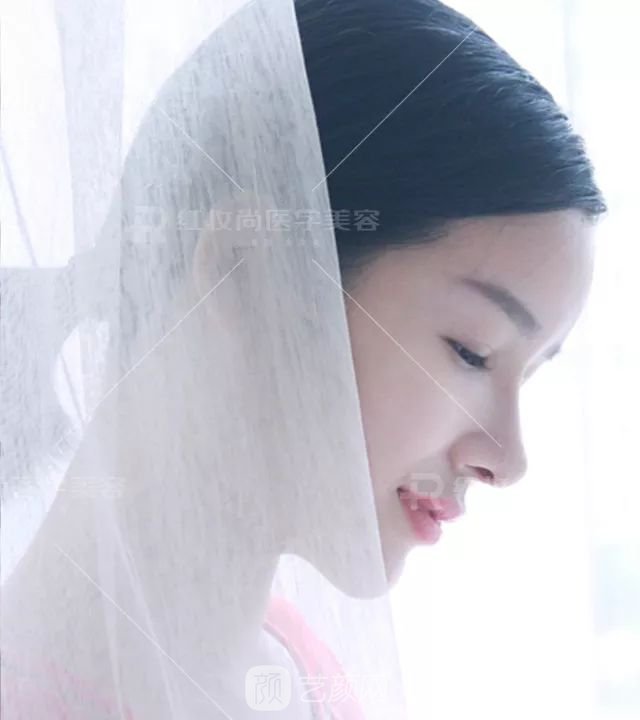 【蜕变日记】绝美侧颜的秘密——分享我的美鼻之旅~
