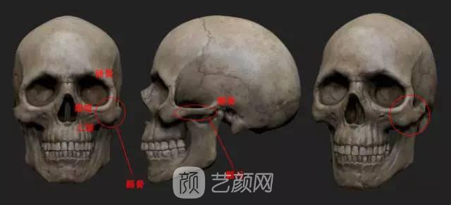 3d颧骨内推多少钱?