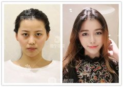 全新美鼻标准流出！符合要求的人长这样~