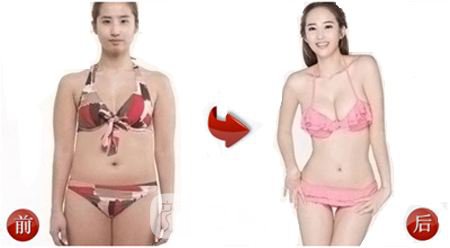 360度环形吸脂果怎么样?