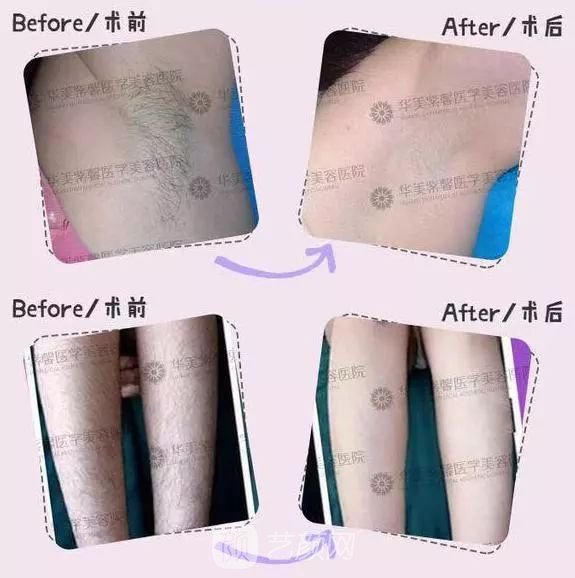 解决这个问题，肌肤直接白两度！