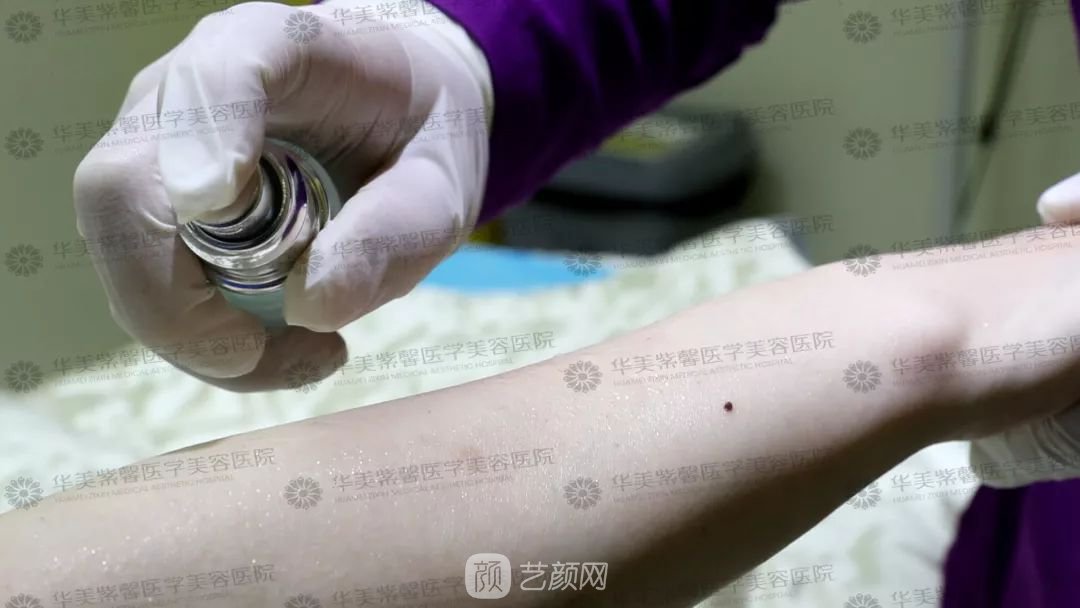 解决这个问题，肌肤直接白两度！