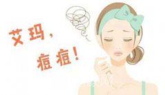 想要去做个激光祛痘，不知道祛痘多少钱?
