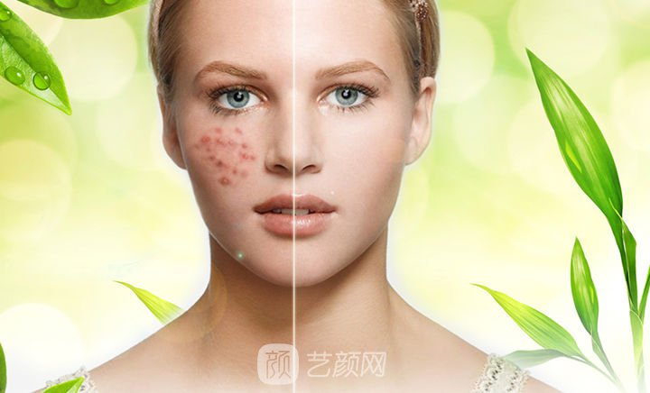 北京激光美容术在哪里做比较好?