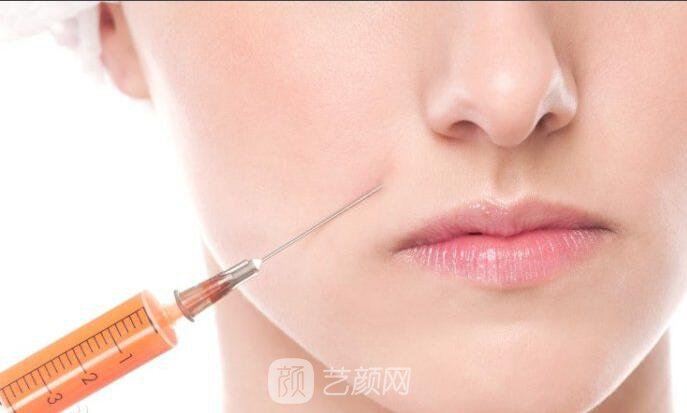 自体脂肪隆鼻尖术怎么样